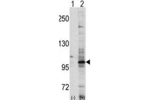 Western Blotting (WB) image for anti-EPH Receptor A7 (EPHA7) antibody (ABIN3003338) (EPH Receptor A7 抗体)