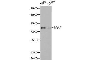 Western blot analysis of extracts of various cell lines, using BRAF antibody. (BRAF 抗体)