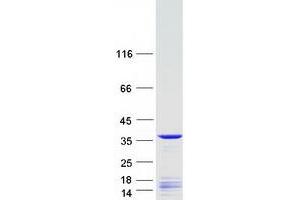 Western Blotting (WB) image for FSHD Region Gene 1 (FRG1) protein (Myc-DYKDDDDK Tag) (ABIN2721412)