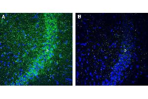 Expression of GPR160 in mouse hippocampus. (GPR160 抗体  (Intracellular))