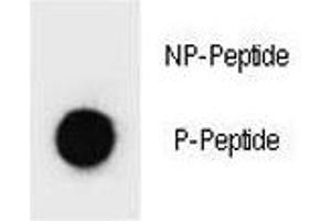 Dot blot analysis of p-PARP1 antibody.