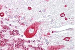 Immunohistochemistry with Brain, cerebellum tissue at an antibody concentration of 5µg/ml using anti-PURA antibody (ARP33202_P050) (PURA 抗体  (Middle Region))