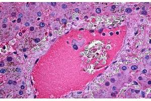 Human Liver: Formalin-Fixed, Paraffin-Embedded (FFPE) (Haptoglobin 抗体)