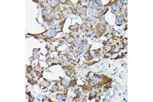 Immunohistochemistry of paraffin-embedded rat liver using SLC14 Rabbit pAb (5991) at dilution of 1:200 (40x lens). (SLC14A1 抗体  (C-Term))