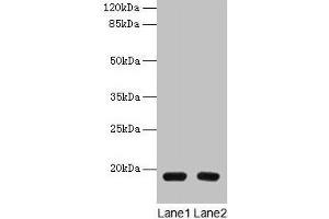 Western blot All lanes: PDE6D antibody at 1.