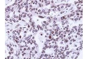 Immunohistochemistry (Paraffin-embedded Sections) (IHC (p)) image for anti-Lamin A/C (LMNA) (AA 59-249) antibody (ABIN497933)