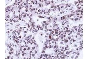 Immunohistochemistry: Lamin A/C antinbody staining of Paraffin-Embedded H441 Xenograft at 1/100 dilution. (Lamin A/C 抗体  (AA 59-249))