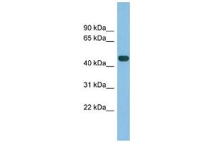 WB Suggested Anti-TFB2M Antibody Titration: 0. (TFB2M 抗体  (N-Term))