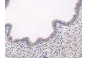 Immunohistochemistry (IHC) image for anti-ADAM Metallopeptidase with Thrombospondin Type 1 Motif, 7 (ADAMTS7) (AA 226-437) antibody (ABIN7437842)