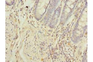 Immunohistochemistry of paraffin-embedded human colon tissue using ABIN7162093 at dilution of 1:100 (FAM55A 抗体  (AA 1-405))