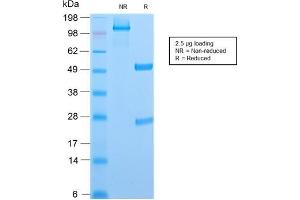 SDS-PAGE Analysis Purified CD6 Rabbit Recombinant Monoclonal Antibody (C6/2884R). (Recombinant CD6 抗体)