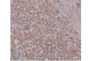 Detection of FGF1 in Rat Spinal Cord Tissue using Monoclonal Antibody to Fibroblast Growth Factor 1, Acidic (FGF1)