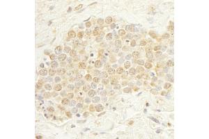 anti-WD Repeat Domain 20 (WDR20) (AA 450-500) antibody