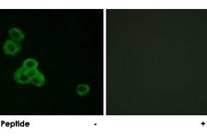 Immunofluorescence analysis of MCF-7 cells, using CAMK2A/CAMK2D polyclonal antibody . (CAMK2A 抗体)