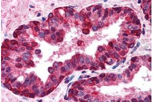 Human Prostate (formalin-fixed, paraffin-embedded) stained with IRF3 antibody ABIN213923 at 5-10 ug/ml followed by biotinylated goat anti-rabbit IgG secondary antibody ABIN481713, alkaline phosphatase-streptavidin and chromogen. (IRF3 抗体  (C-Term))
