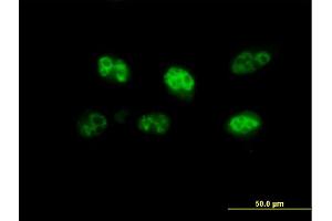 Immunofluorescence of purified MaxPab antibody to FBXO7 on HeLa cell. (FBXO7 抗体  (AA 1-522))