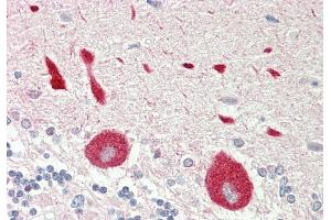 Rabbit Anti-STYK1 antibody  Formalin Fixed Paraffin Embedded Tissue: Human Brain, Cerebellum Primary antibody Concentration: 1:100 Secondary Antibody: Donkey anti-Rabbit-Cy3 Secondary Antibody Concentration: 1:200 Magnification: 20x Exposure Time: 0. (STYK1 抗体  (C-Term))