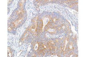 anti-Metastasis Associated in Colon Cancer 1 (MACC1) (AA 100-150) antibody