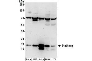 Western Blotting (WB) image for anti-Stathmin 1 (STMN1) (AA 99-149) antibody (ABIN7453278)
