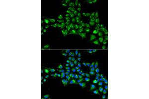 Immunofluorescence analysis of HeLa cells using CYGB antibody (ABIN5973882). (CYGB 抗体)
