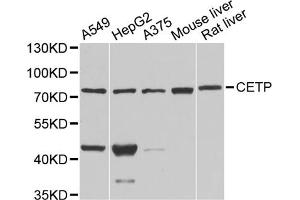 Western blot analysis of extracts of various cell lines, using CETP antibody. (CETP 抗体)