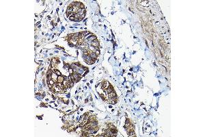 Immunohistochemistry (IHC) image for anti-Annexin A13 (ANXA13) (AA 1-316) antibody (ABIN6136922)