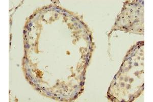 Immunohistochemistry of paraffin-embedded human testis tissue using ABIN7155653 at dilution of 1:100 (BARX1 抗体  (AA 1-100))