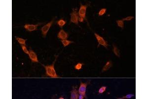 Immunofluorescence analysis of NIH-3T3 cells using UFC1 Polyclonal Antibody at dilution of 1:100 (40x lens). (UFC1 抗体)
