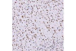 IHC analysis of Optineurin using anti-Optineurin antibody (ABIN3042498). (OPTN 抗体  (AA 241-577))
