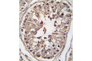 Formalin-fixed and paraffin-embedded human testis tissue reacted with TBK-p, which was peroxidase-conjugated to the secondary antibody, followed by DAB staining. (TBK1 抗体  (AA 150-181))
