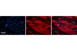 Rabbit Anti-ENO3 Antibody    Formalin Fixed Paraffin Embedded Tissue: Human Adult heart  Observed Staining: Cytoplasmic Primary Antibody Concentration: 1:100 Secondary Antibody: Donkey anti-Rabbit-Cy2/3 Secondary Antibody Concentration: 1:200 Magnification: 20X Exposure Time: 0. (ENO3 抗体  (N-Term))