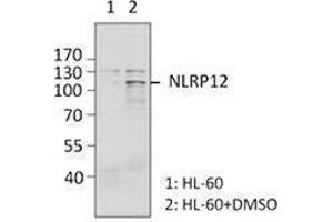 Western Blotting (WB) image for anti-NLR Family, Pyrin Domain Containing 12 (NLRP12) antibody (ABIN2665297) (NLRP12 抗体)