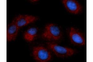 Immunofluorescence (IF) image for anti-Cathepsin E (CTSE) (AA 57-363) antibody (APC) (ABIN5565230)