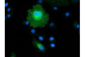 Anti-MAPRE2 mouse monoclonal antibody (ABIN2454619) immunofluorescent staining of COS7 cells transiently transfected by pCMV6-ENTRY MAPRE2 (RC200259). (MAPRE2 抗体)
