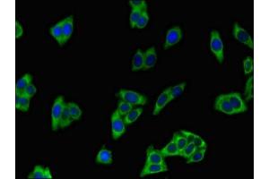 Immunofluorescent analysis of HepG2 cells using ABIN7163370 at dilution of 1:100 and Alexa Fluor 488-congugated AffiniPure Goat Anti-Rabbit IgG(H+L)