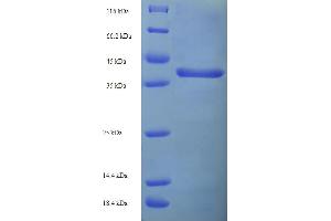 SDS-PAGE (SDS) image for Carnitine Palmitoyltransferase 1C (CPT1C) (AA 114-333), (partial) protein (His-SUMO Tag) (ABIN5709369) (CPT1C Protein (AA 114-333, partial) (His-SUMO Tag))
