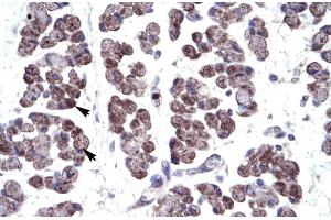 Immunohistochemistry (IHC) image for anti-T-Box 20 (TBX20) (N-Term) antibody (ABIN2777791)
