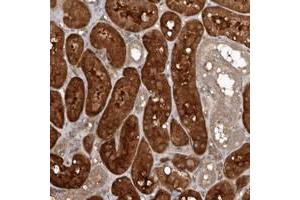 Immunohistochemical staining of human kidney with EXOC3L1 polyclonal antibody  shows strong cytoplasmic positivity in cells in tubules at 1:200-1:500 dilution. (EXOC3L1 抗体)