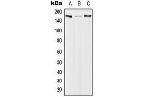 Western blot analysis of EGFR (pT678) expression in A431 EGF-treated (A), NIH3T3 EGF-treated (B), PC12 EGF-treated (C) whole cell lysates. (EGFR 抗体  (pSer678))