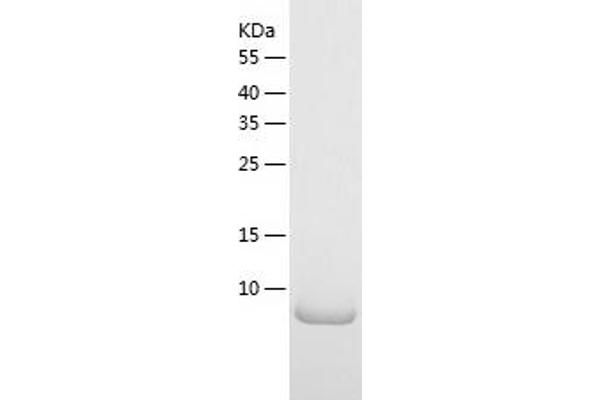 CMC4 Protein (AA 1-68) (His tag)