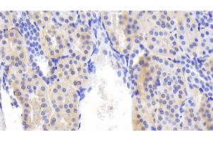 Detection of BMP6 in Human Kidney Tissue using Polyclonal Antibody to Bone Morphogenetic Protein 6 (BMP6) (BMP6 抗体  (AA 375-513))