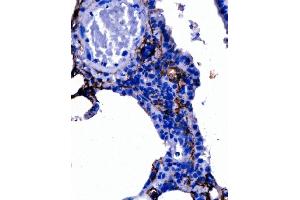 IHC analysis of Podoplanin/gp36/Pdpn using anti-Podoplanin/gp36/Pdpn antibody (ABIN7600811). (Podoplanin 抗体  (AA 24-172))