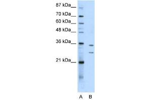 BXDC5 antibody used at 0. (RPF1 抗体  (N-Term))