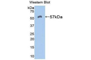 Western Blotting (WB) image for anti-Aldehyde Dehydrogenase 7 Family, Member A1 (ALDH7A1) (AA 29-539) antibody (ABIN1077760) (ALDH7A1 抗体  (AA 29-539))