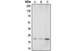 Western blot analysis of Caveolin 1 expression in A549 (A), mouse brain (B), rat kidney (C) whole cell lysates. (Caveolin-1 抗体  (N-Term))