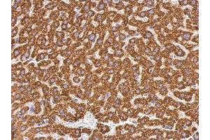 IHC-P Image ABAT antibody detects ABAT protein at mitochondria on mouse liver by immunohistochemical analysis. (ABAT 抗体)