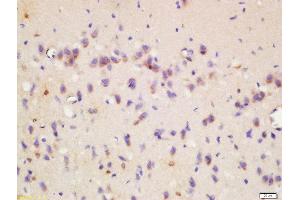 Formalin-fixed and paraffin embedded rat brain labeled with Rabbit Anti-Wnt8b Polyclonal Antibody, Unconjugated  at 1:200 followed by conjugation to the secondary antibody and DAB staining (WNT8B 抗体  (AA 131-230))