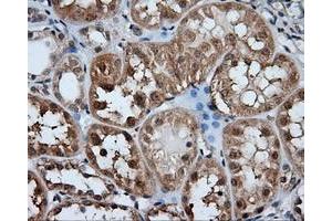 Immunohistochemical staining of paraffin-embedded liver tissue using anti-HDAC10 mouse monoclonal antibody. (HDAC10 抗体)