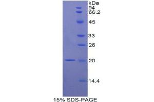 SDS-PAGE analysis of Rat Interleukin 17B Protein. (IL17B 蛋白)