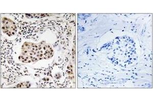 Immunohistochemistry (IHC) image for anti-Protein Phosphatase 1, Regulatory (Inhibitor) Subunit 11 (PPP1R11) (AA 71-120) antibody (ABIN1535219)